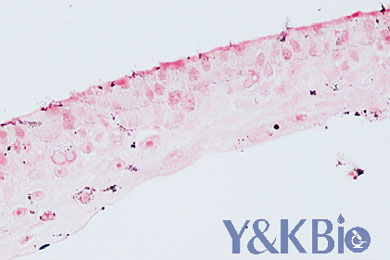 内蒙古masson银染