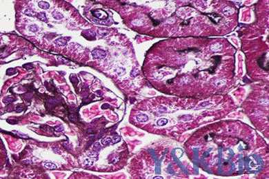 内蒙古六胺银染色