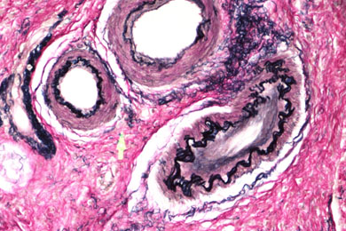 内蒙古弹力纤维染色