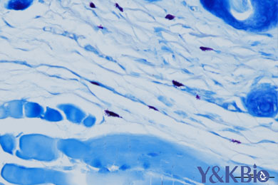 内蒙古甲苯胺蓝染色