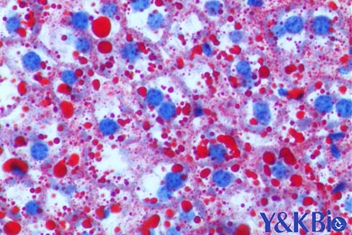 内蒙古油红O染色