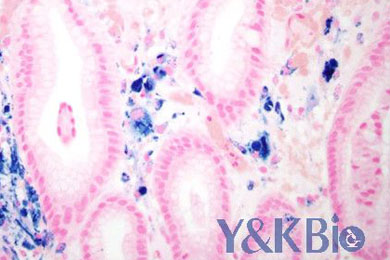 内蒙古普鲁士蓝染色