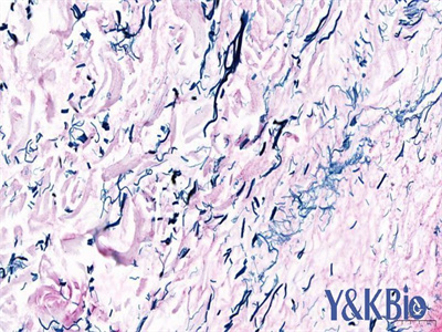 内蒙古维多利亚蓝染色