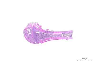 内蒙古脱钙（慢脱）