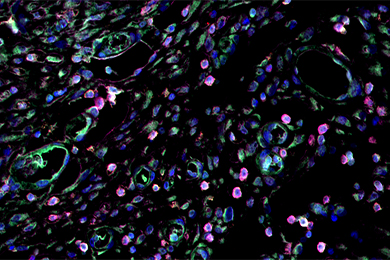 内蒙古普通切片（荧光三标 四色）扫描
