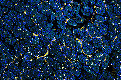 内蒙古普通切片（荧光四标 五色）扫描