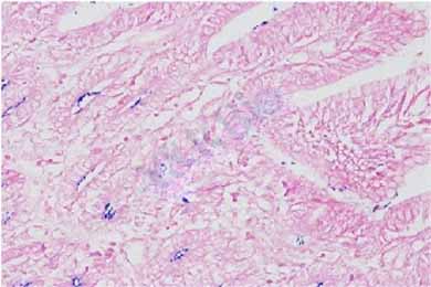 内蒙古革兰氏染色