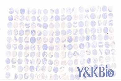 内蒙古白光芯片扫描