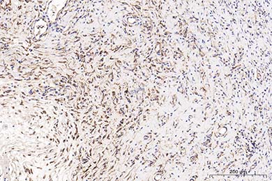 内蒙古Anti-CD34 Antibody [SI16-01]