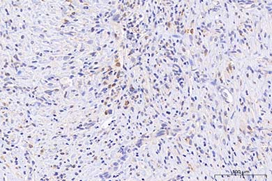 内蒙古Anti-iNOS Antibody