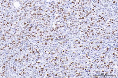 内蒙古Anti-Ki67 Antibody [SR00-02]